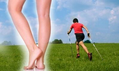 Allowed type of walk for varicose veins